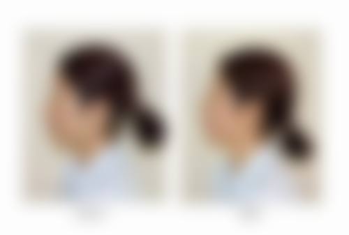 邛崃熹亚西美整形医院价格参考