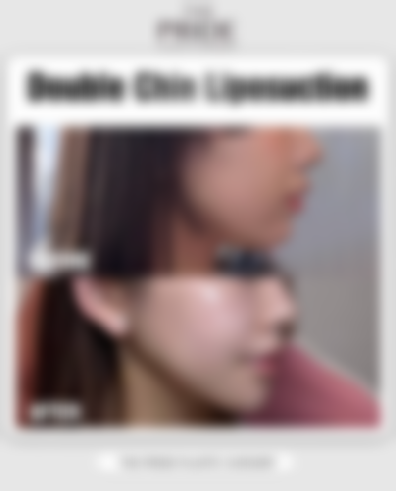 昆明医 科 大学第二附属医院(整形外科)交通路线与预约