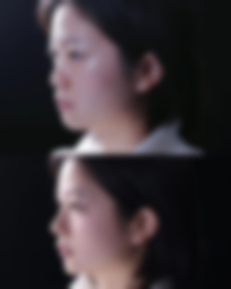 潜江白衣天使医疗整形医院价格参考