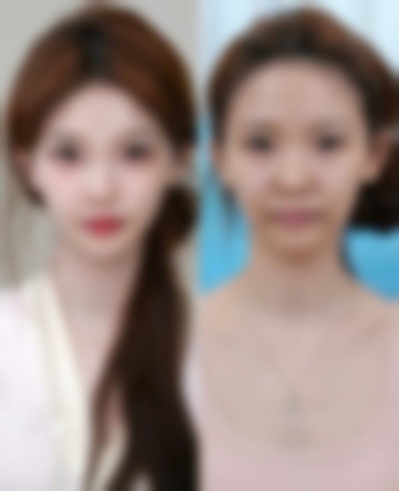 大庆简一美整形医院患者评价