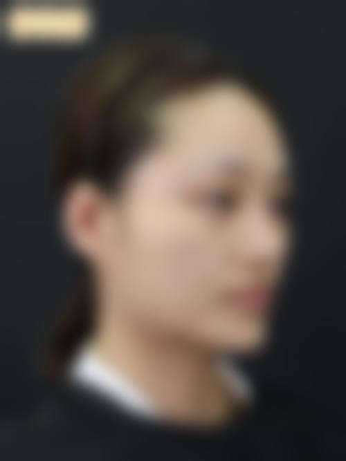 杭州同欣整形美容医院价格参考