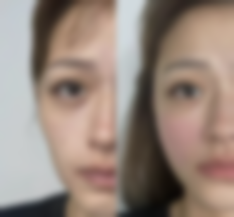 陕西新素原美医疗美容患者评价