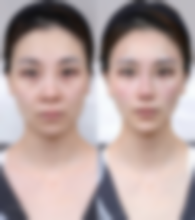 广州雅静美整形医院交通路线与预约