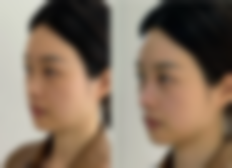 哈尔滨香王医生坊整形美容医院核心项目