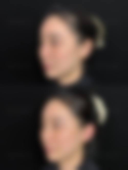 潍坊李储忠整形医疗美容诊所价格参考