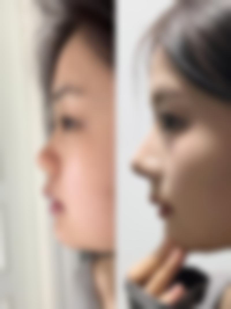 李纯明擅长项目列表