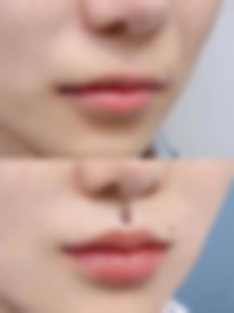 杭州宸山医疗美容门诊部核心项目