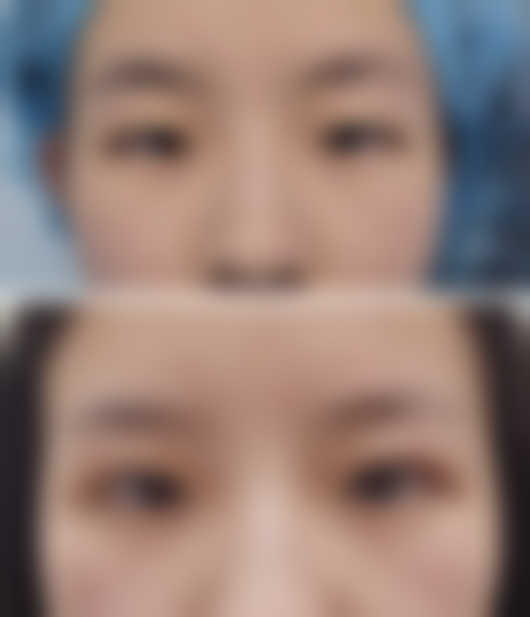 东阳禾栗整形医院患者评价