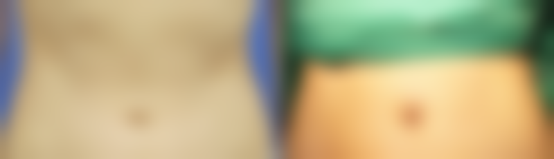 珠海中健速医美整形医院价格参考