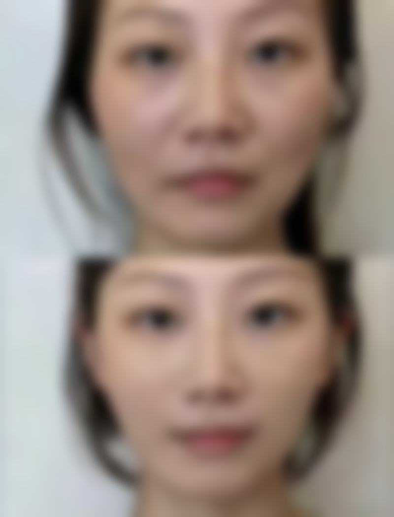 管岚擅长项目列表