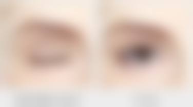 太原万美整形美容医院价格参考