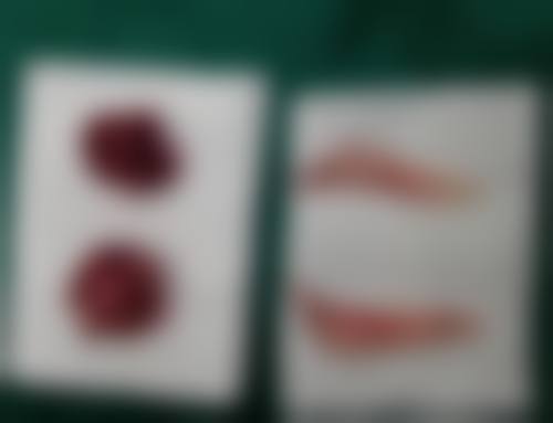 吴锁法预约方式