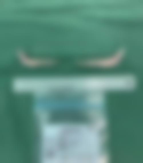 吴锁法预约方式