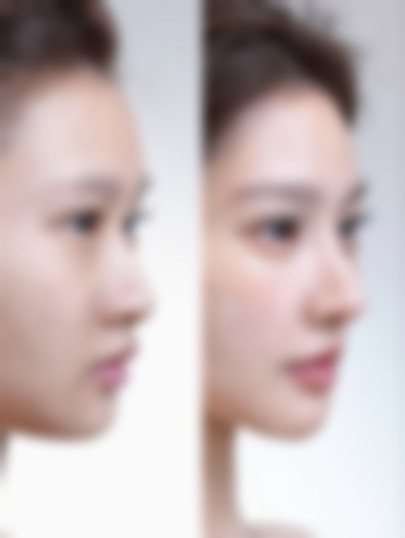 吴锁法擅长项目列表