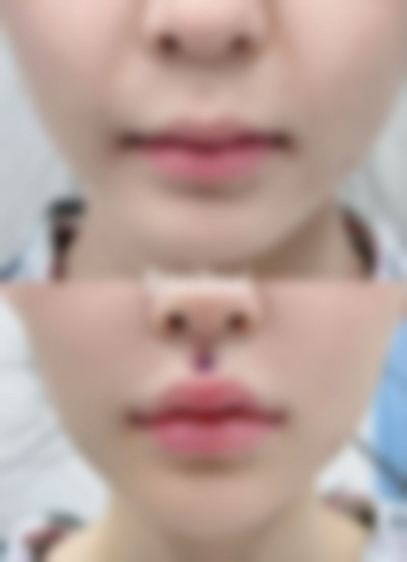 太原万美整形美容医院核心项目