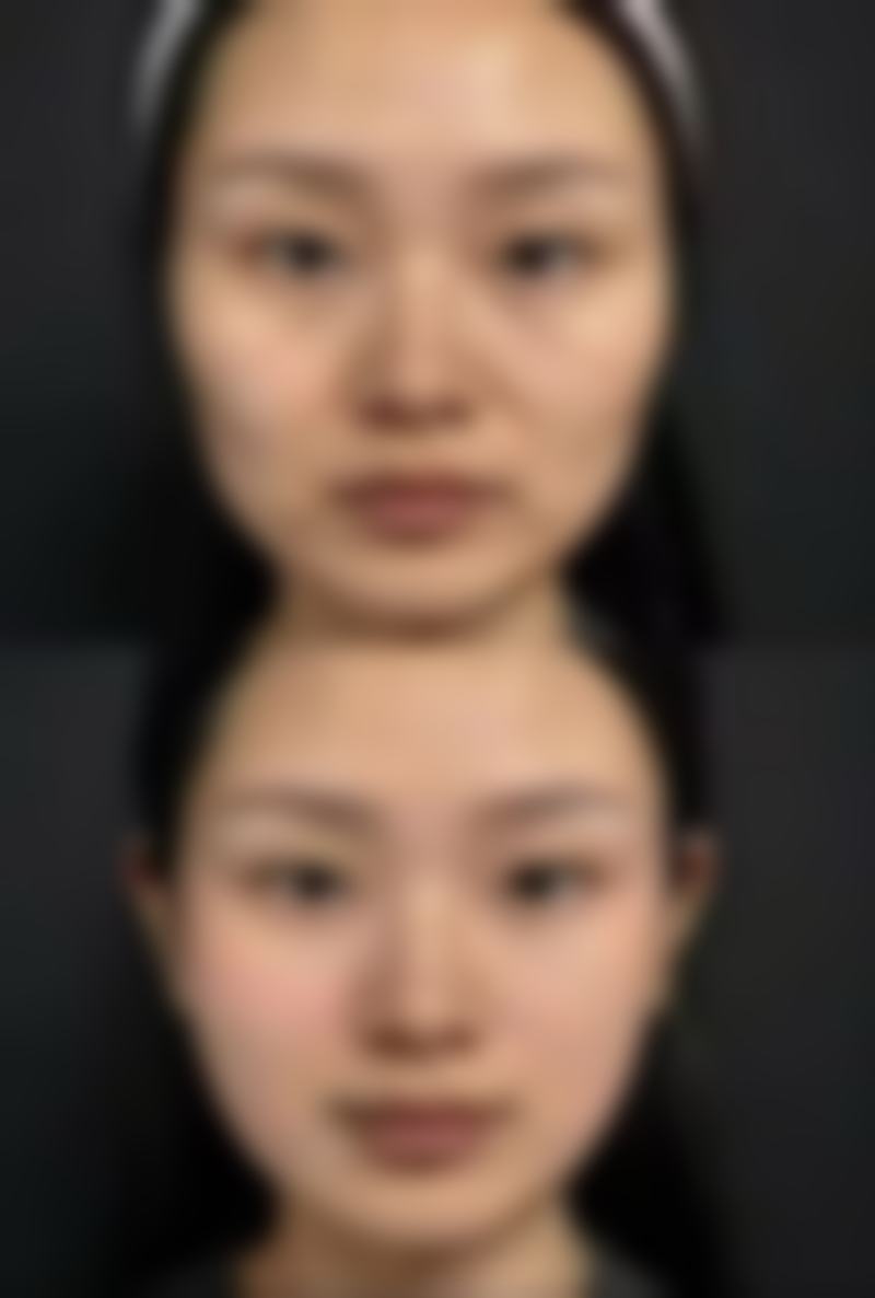 沈阳李铁民整形医疗美容诊所核心项目