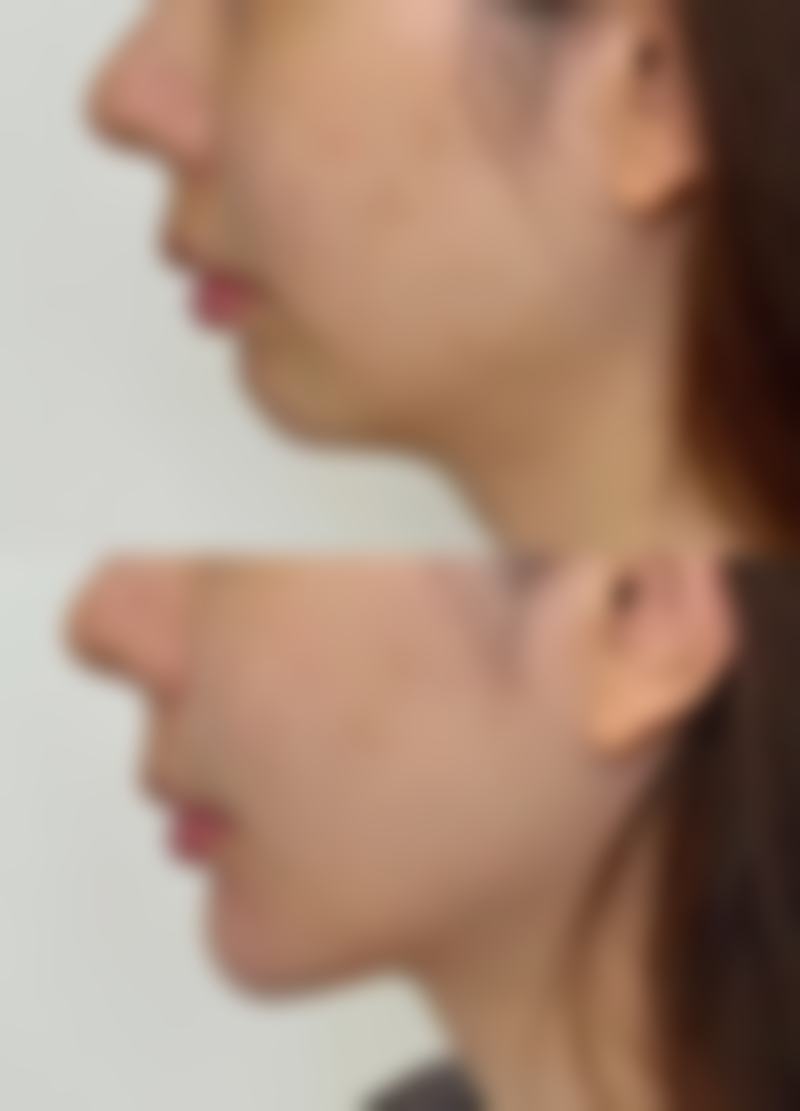 钟萍霞患者评价