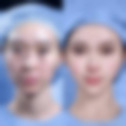 深圳翠锦清颜整形医院患者评价