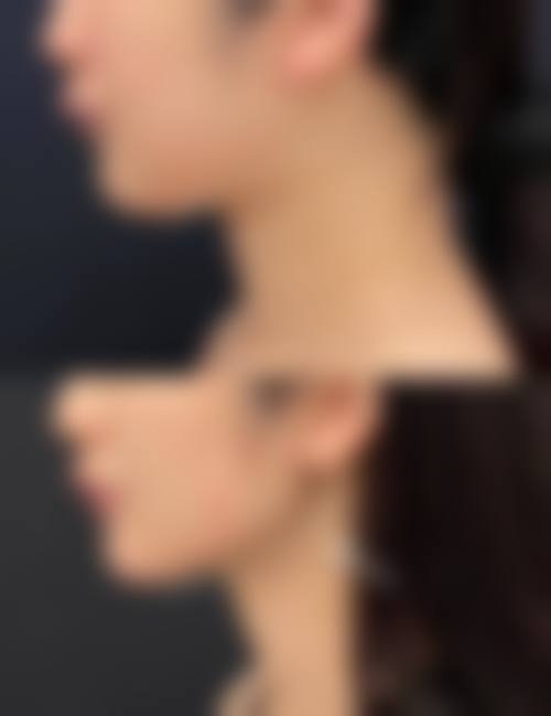 赣州光泽整形医院核心项目