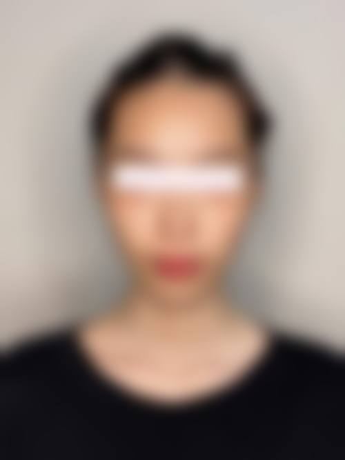 重庆博爱医院整形美容中 心患者评价