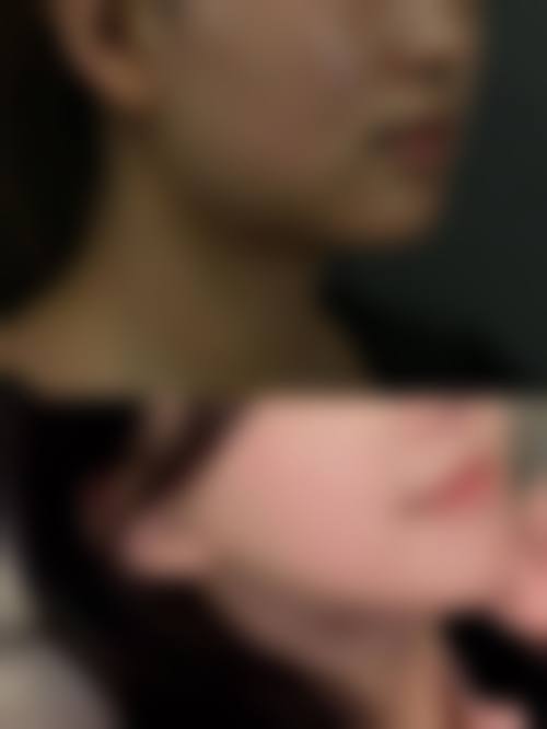 耒阳蕊菲兰积整形医院患者评价