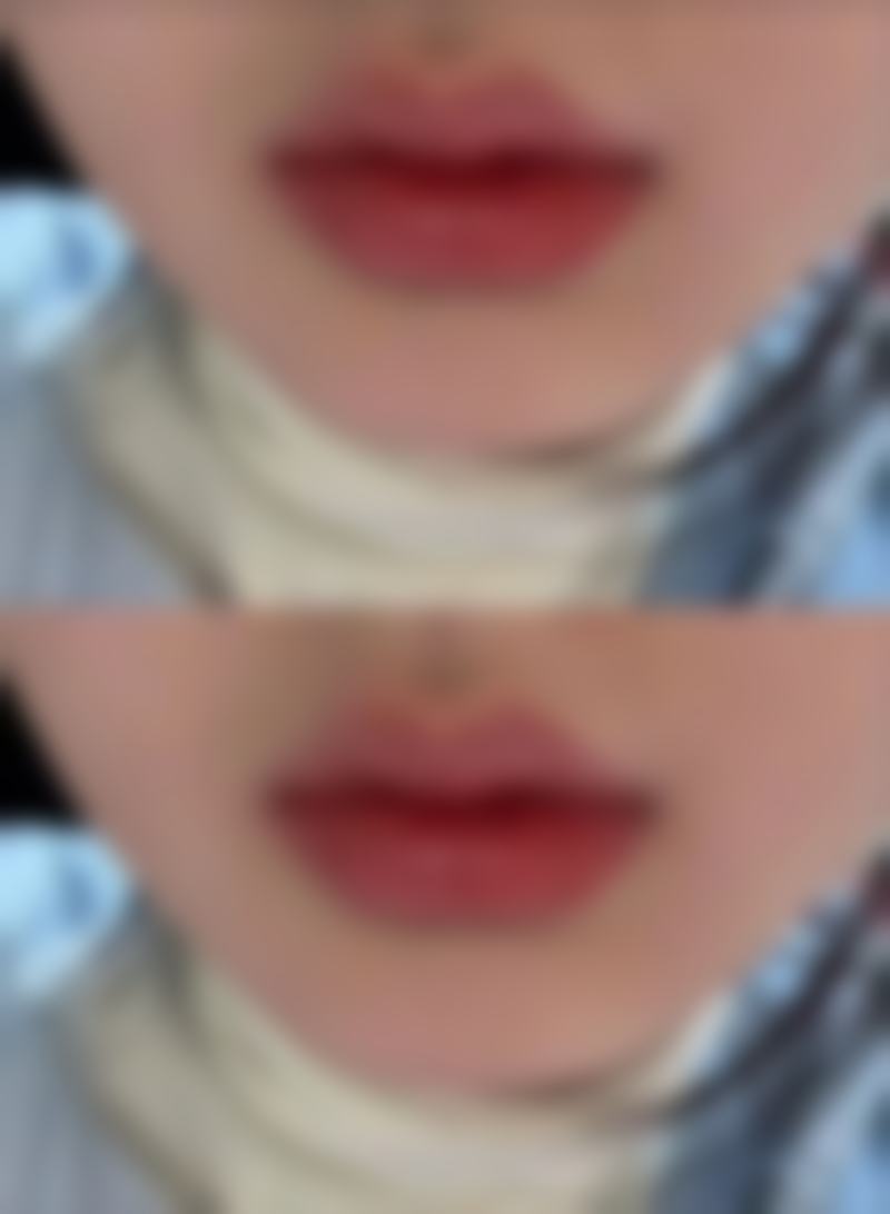 长沙芙蓉美德思整形医院核心项目