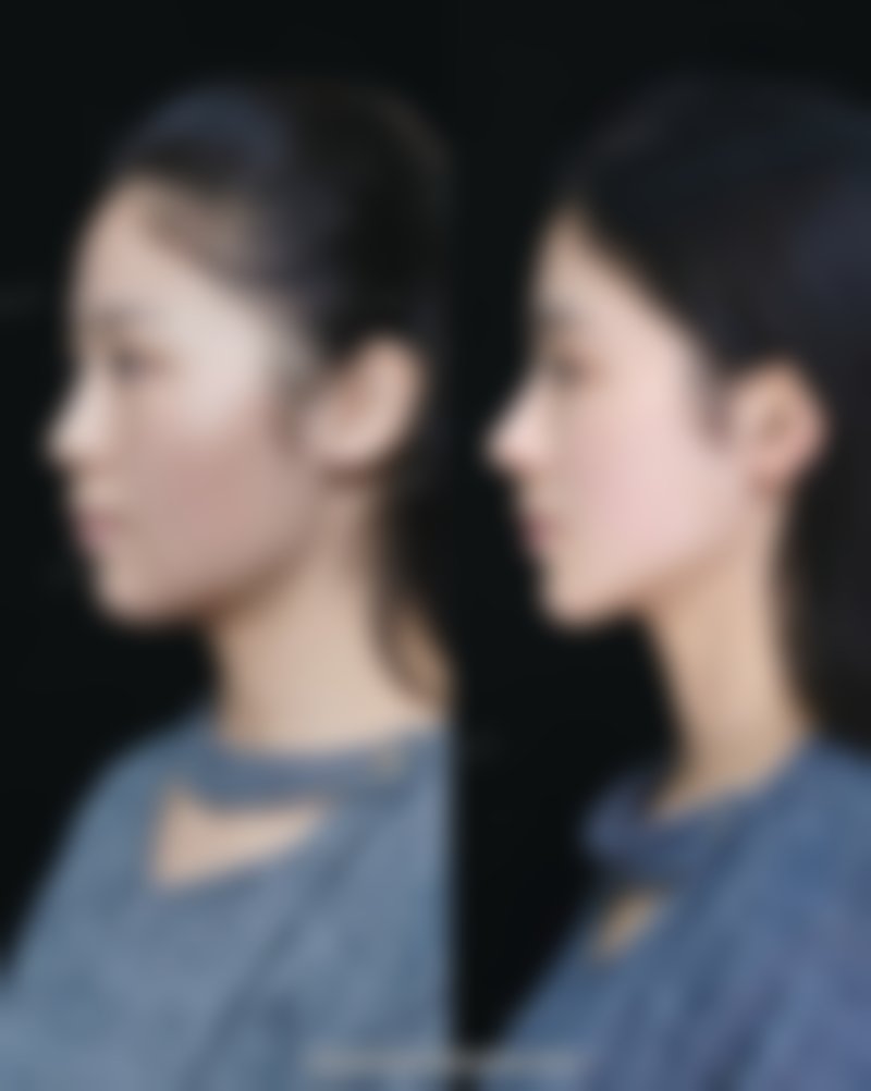 成都欧菲整形医疗美容门诊部交通路线与预约