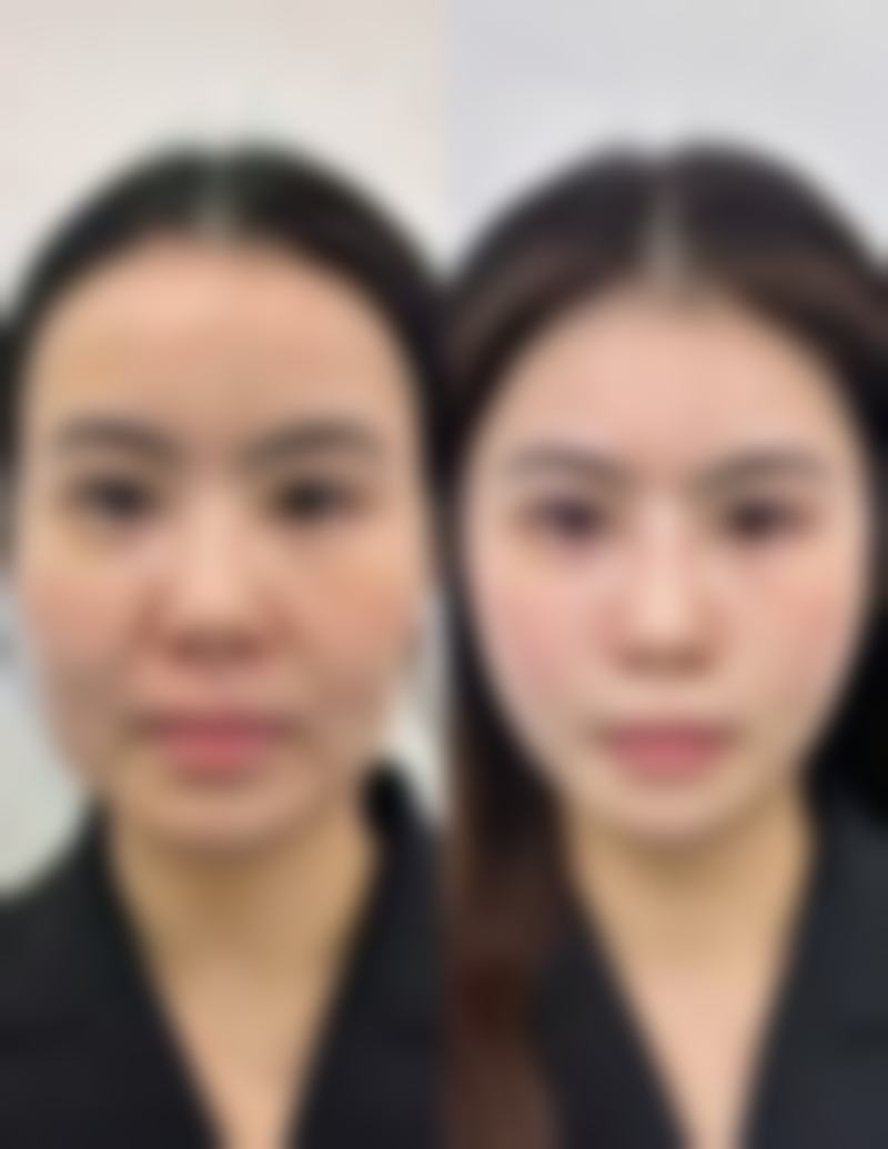 沈阳金皇后长白岛远洋整形医院价格参考