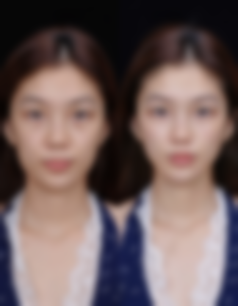 成都欧菲整形医疗美容门诊部核心项目