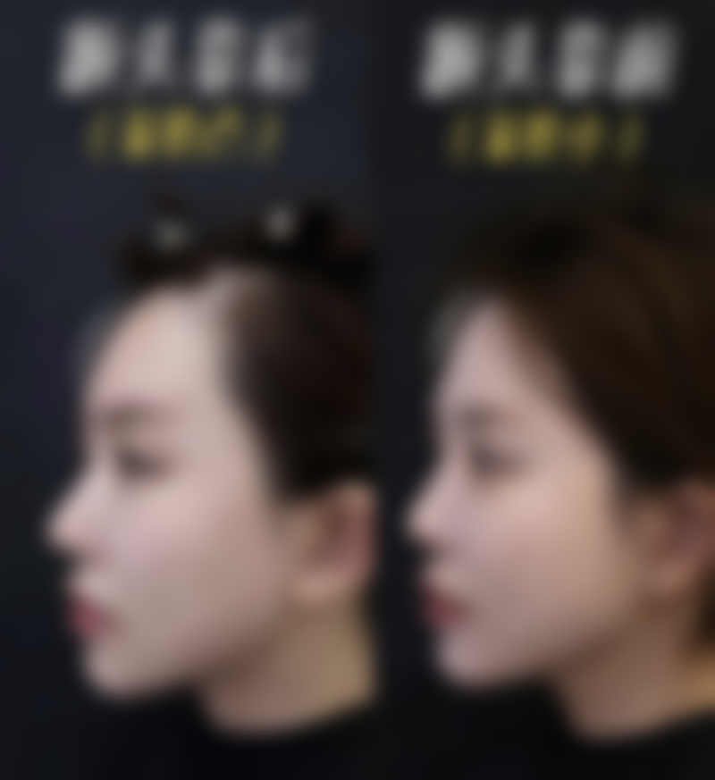 东莞美天美整形医院价格参考