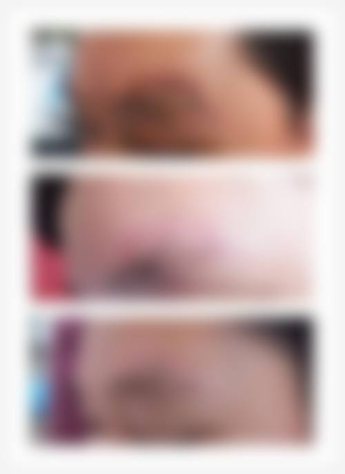 南昌美皇医疗整形美容医院患者评价