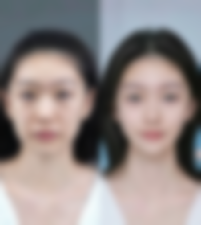 大石桥星悦柠檬整形医院正规资质