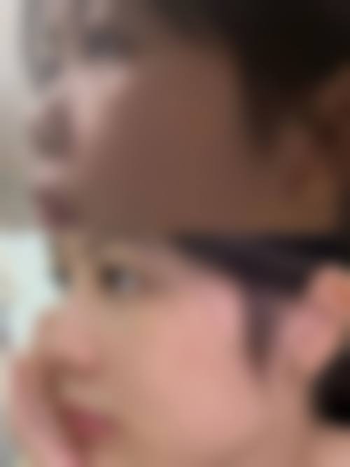 天津塘沽汉诚医学美容门诊价格参考