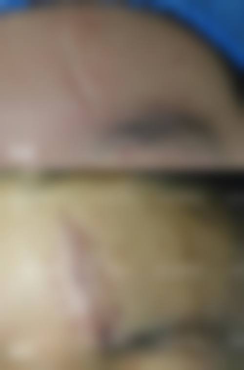 解放军150医院激光美容中 心交通路线与预约