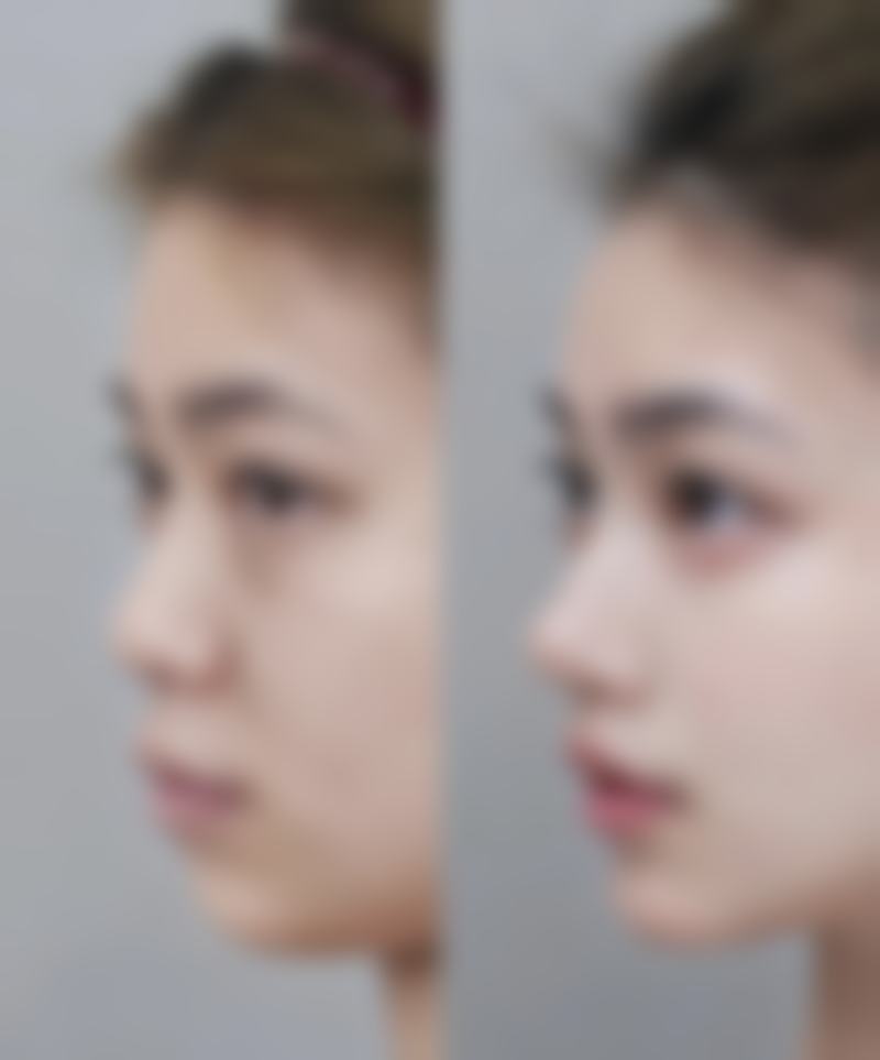 王惠芳患者评价