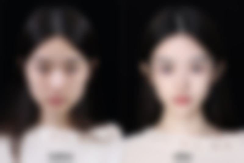 贵阳甄美姬医疗美容核心项目