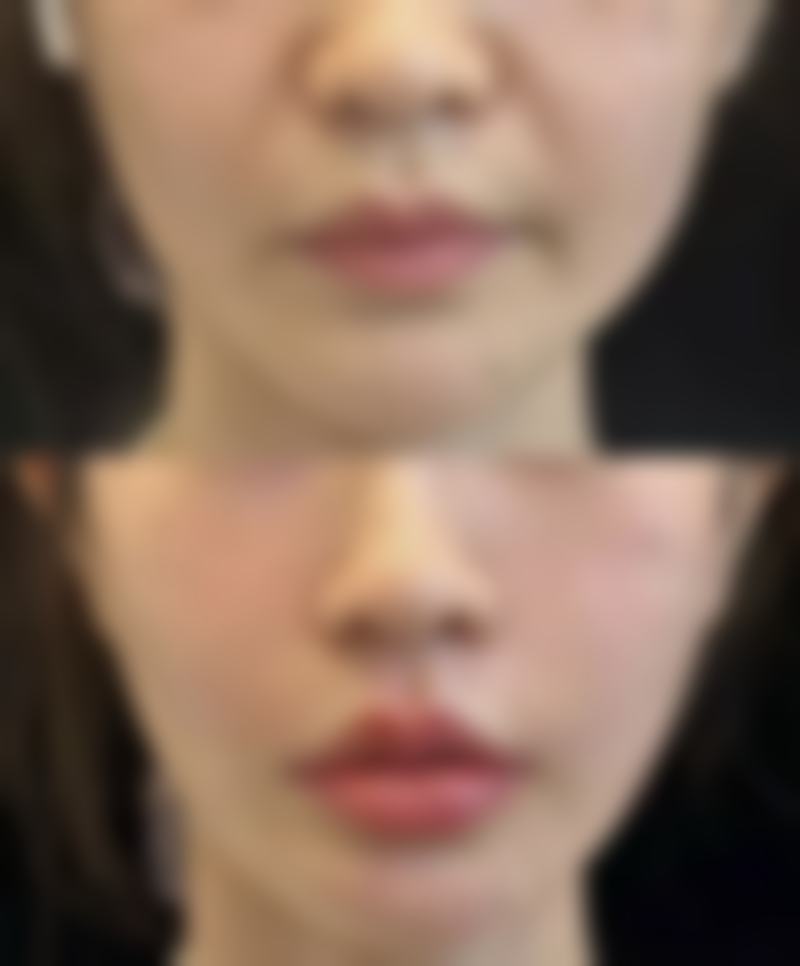 KEYE 眼科医院患者评价