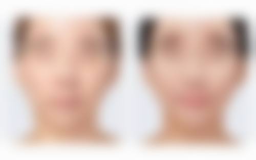 中山如花整形医疗美容门诊部患者评价