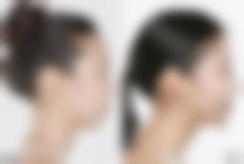 王惠芳擅长项目列表