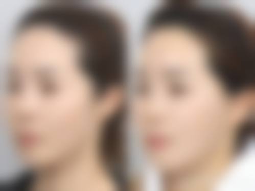 宁波欧华美之术整形医疗美容医院患者评价