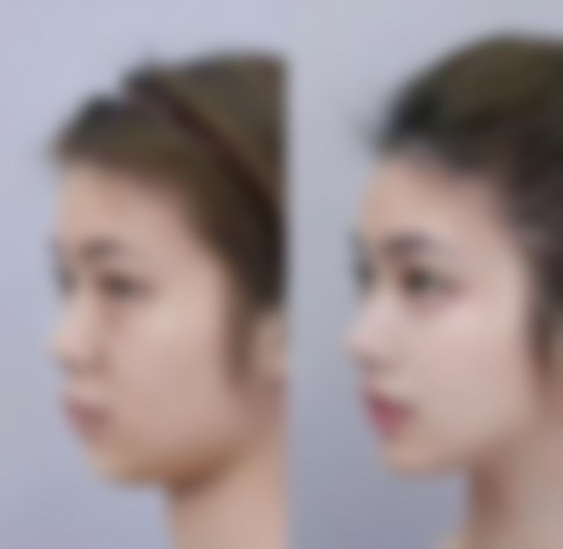 集安钰臻外科整形诊所核心项目