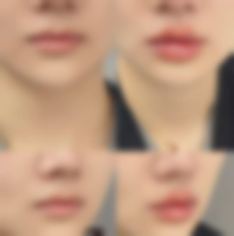 合阳县柠檬树整形医院价格参考