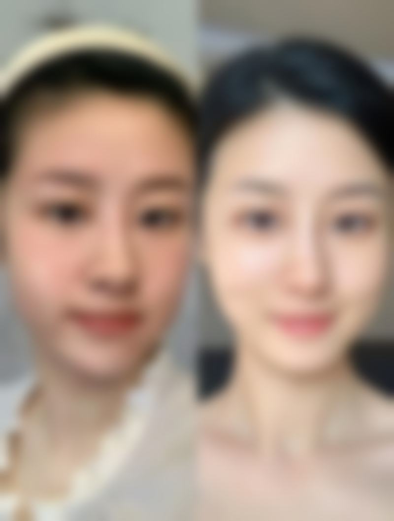 毕节博丽医疗整形美容诊所核心项目