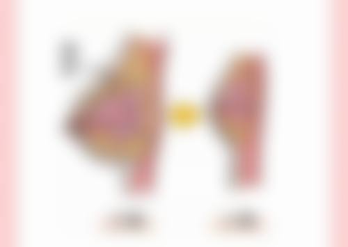 达州紫蝴蝶整形美容患者评价