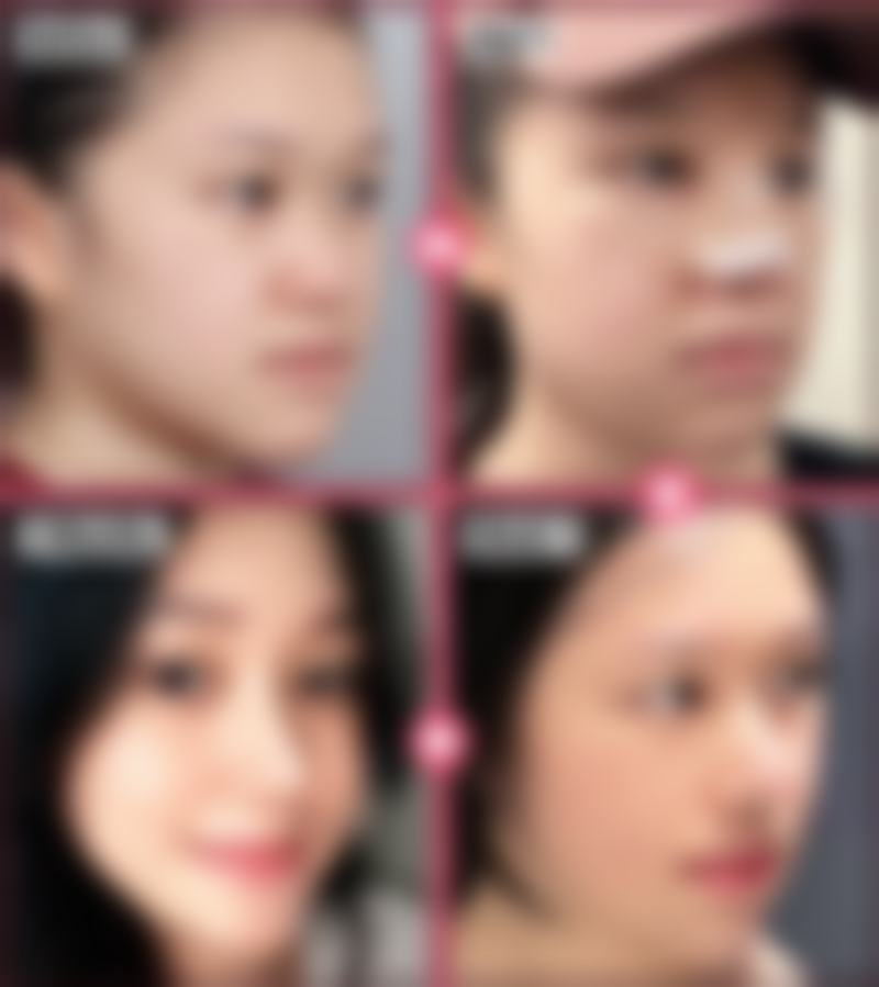 达州紫蝴蝶整形美容价格参考