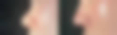 嬴胡川擅长项目列表