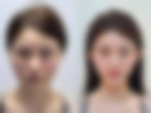 陈秀芸患者评价