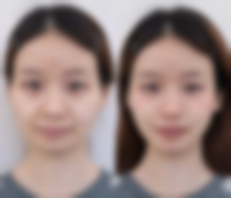 嬴胡川技术水平评价