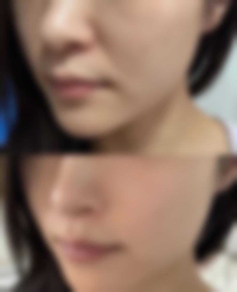 嬴胡川患者评价