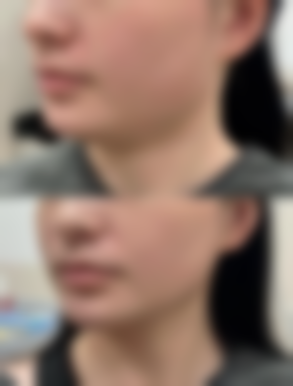 钟盛全擅长项目列表